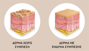 μετεγχειρητικά ενδύματα αποτέλεσμα